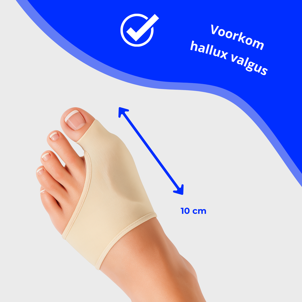 Hallux Valgus