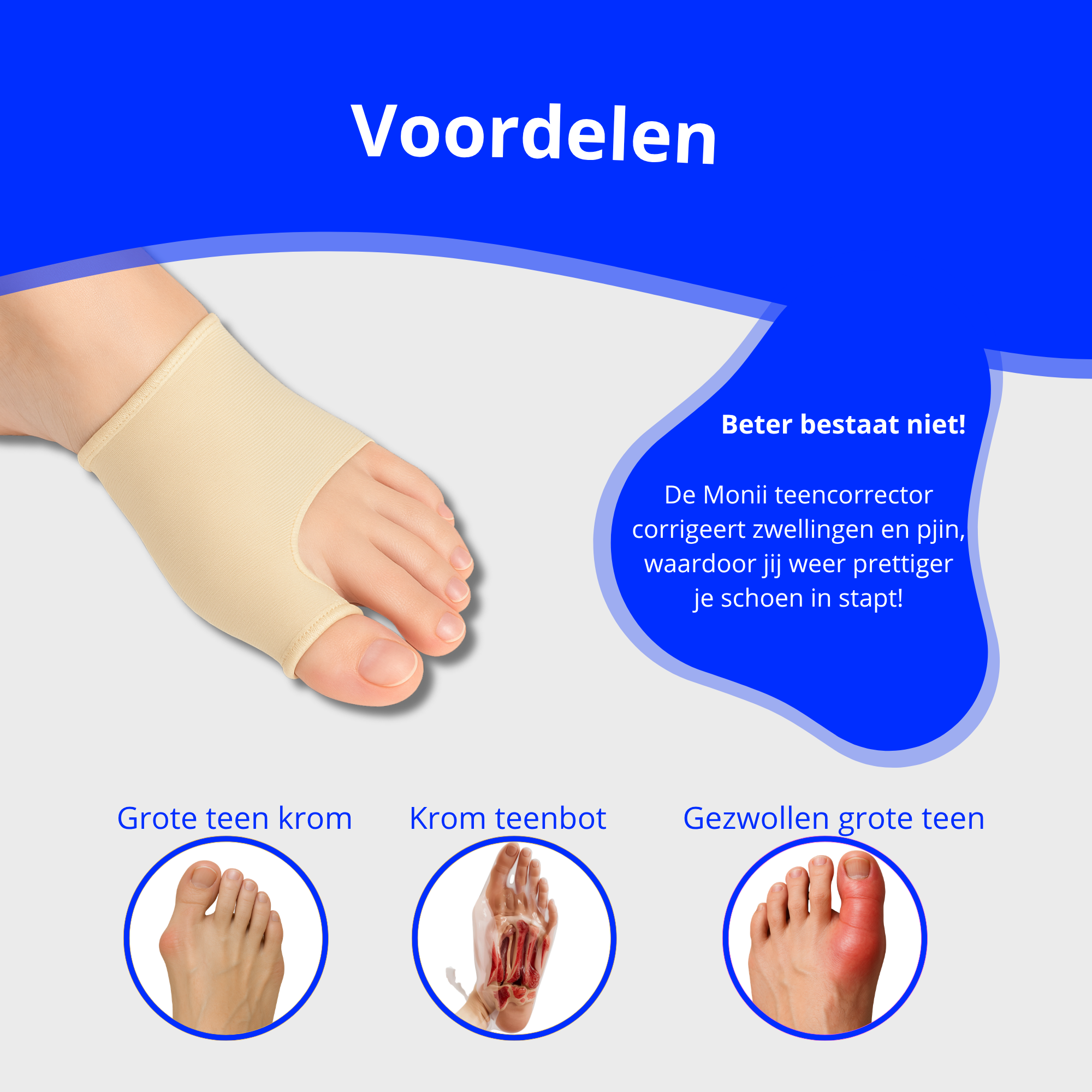 Hallux Valgus